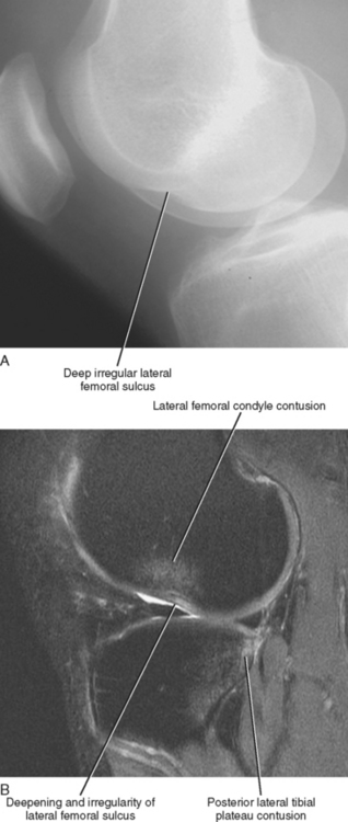 IMAGING OF THE KNEE Radiology Key IMAGING OF THE KNEE Radiology Key
