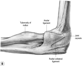 The elbow | Radiology Key