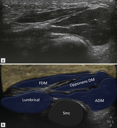 Forearm and Wrist Joint: Anatomy and Techniques | Radiology Key