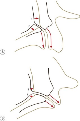 Embryology and development | Radiology Key