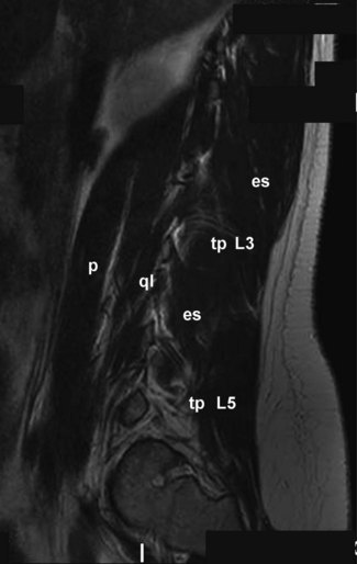 Sagittal magnetic resonance scans | Radiology Key