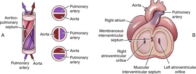 Image result for aorticopulmonary septum