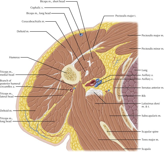 Upper Arm | Radiology Key