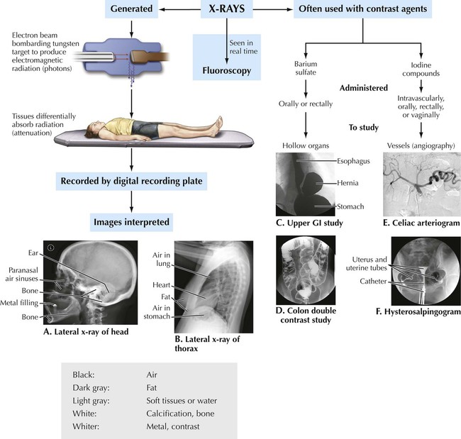 Eradiology Sella Turcica Bone Function Site Location Anatomy Eradiology Sella Turcica Bone Function Site Location Anatomy