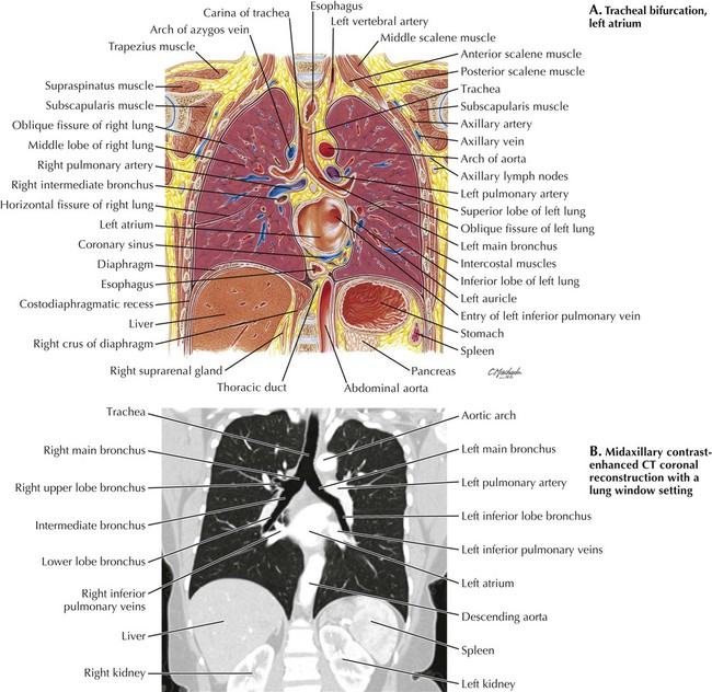Thorax Radiology Key