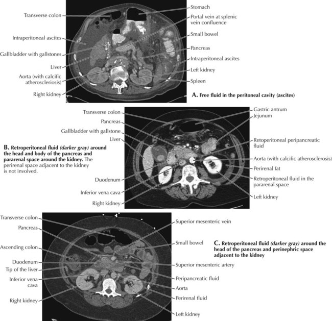 Abdomen | Radiology Key