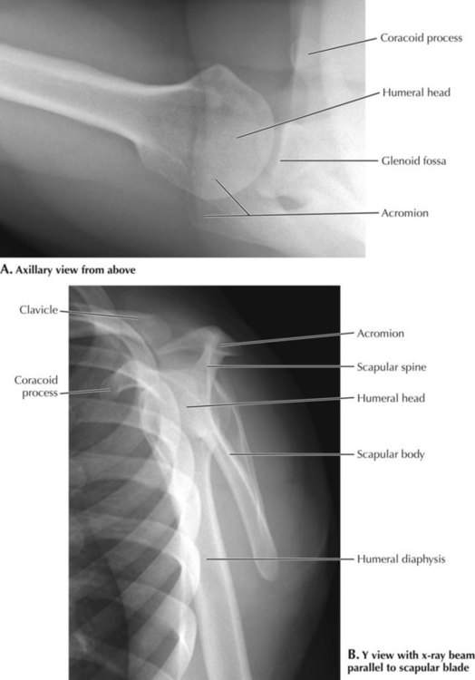 Upper Limbs | Radiology Key