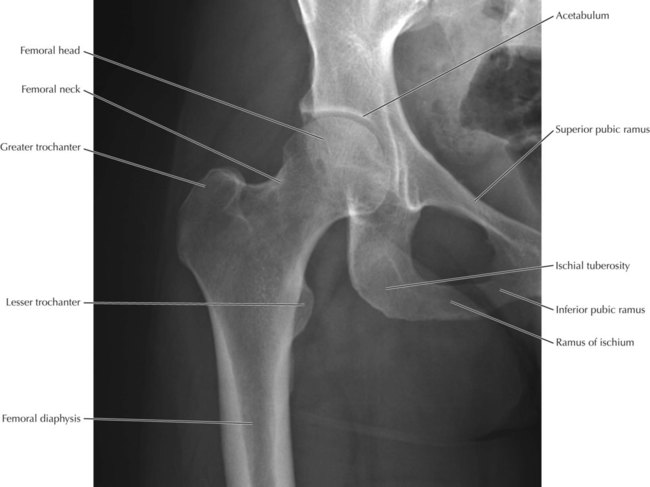 femur x ray anatomy