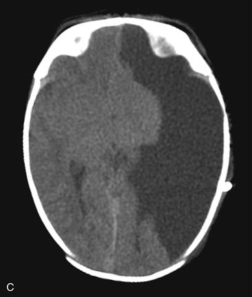 104 | Radiology Key