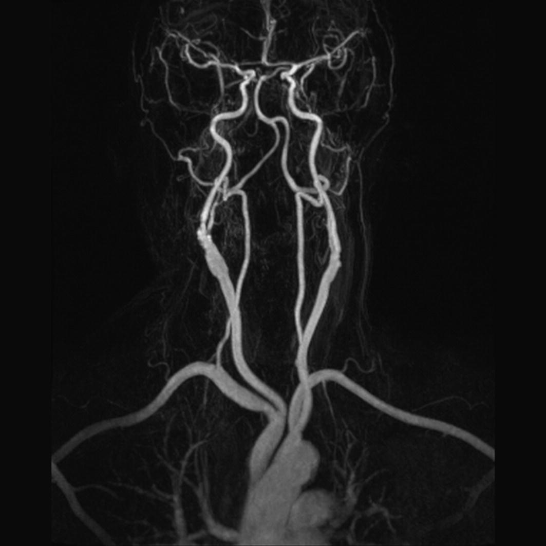 Head And Neck Radiology Key