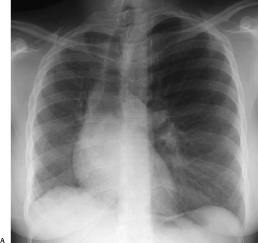 5 | Radiology Key