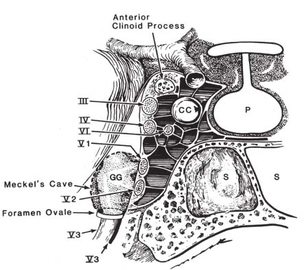 Abducens Nerve | Radiology Key