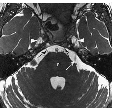 Fig. 6.6