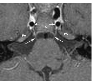 Fig. 6.7