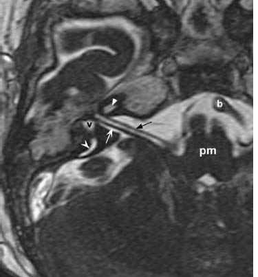 Fig. 8.9