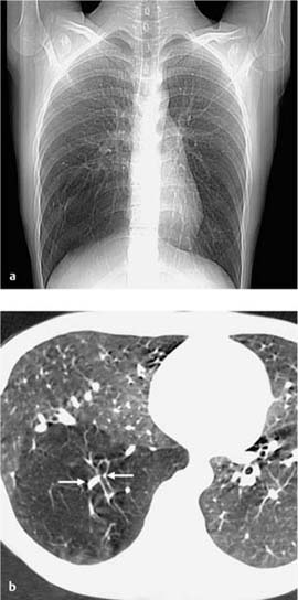 Congenital Disorders | Radiology Key