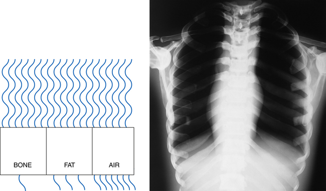 direct exposure x-ray film