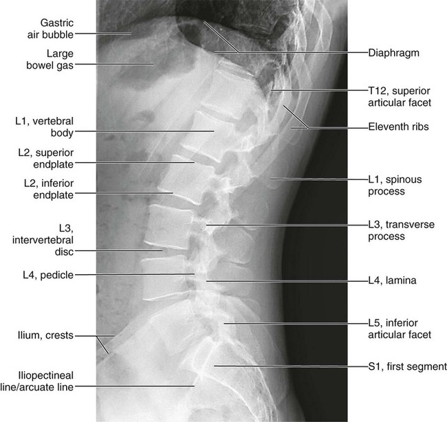 Normal Anatomy | Radiology Key
