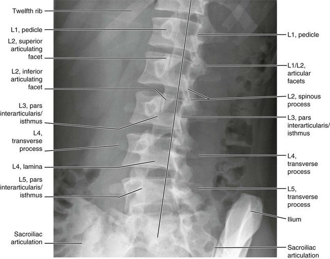 Normal Anatomy | Radiology Key