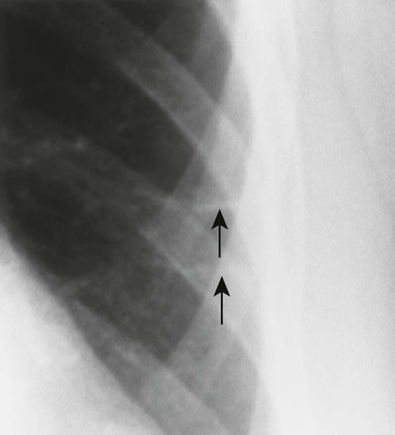 Circulation and the Heart | Radiology Key