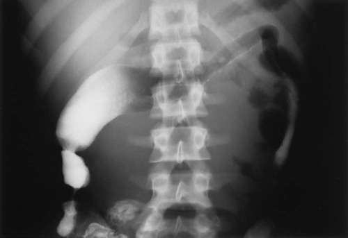 Gastrointestinal Diseases | Radiology Key