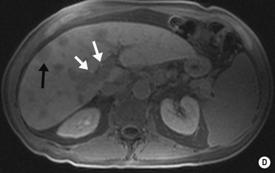 Liver | Radiology Key