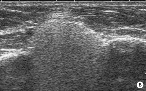 Breast | Radiology Key