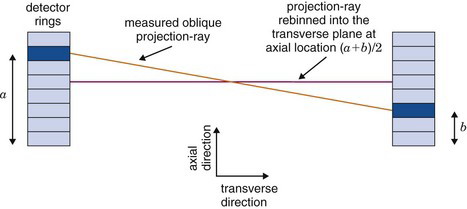 Tomographic Reconstruction in Nuclear Medicine | Radiology Key