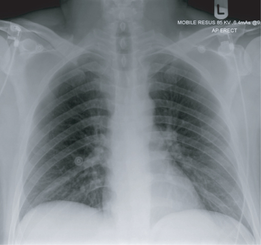 Chest | Radiology Key