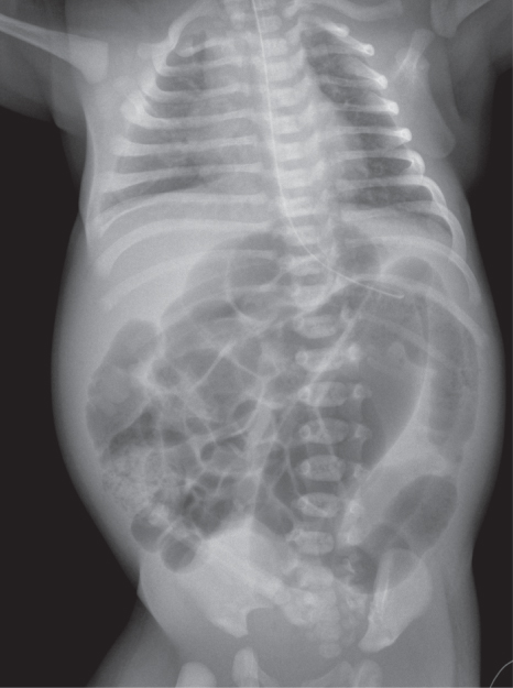 Emergency Paediatric Radiology | Radiology Key