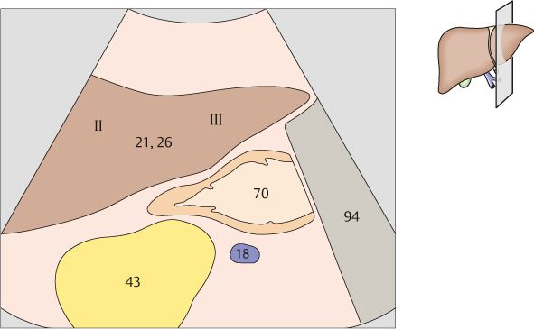 Liver Radiology Key