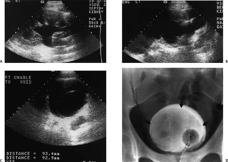 Renal Failure Radiology Key