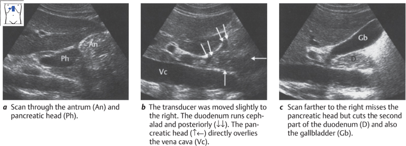 pancreas ultrasound