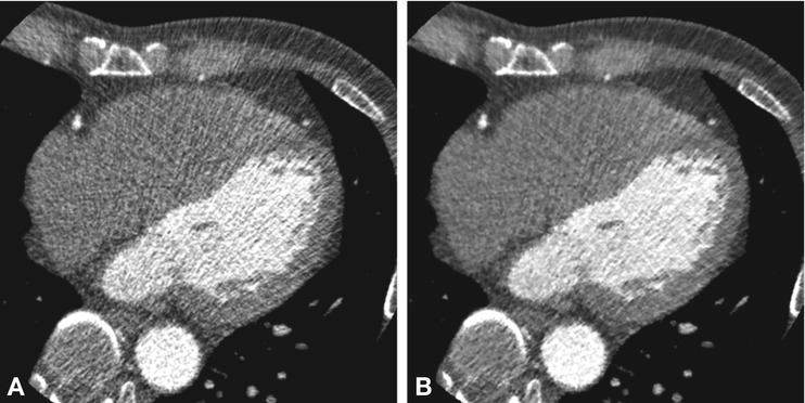 Examination and Reconstruction | Radiology Key