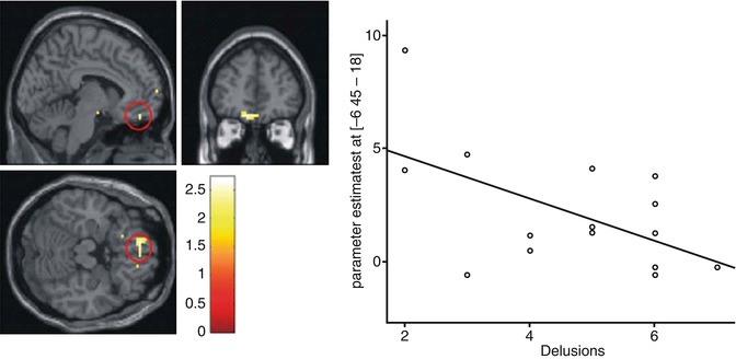 fMRI Investigations of the Mesolimbic Dopaminergic Reward System in ...