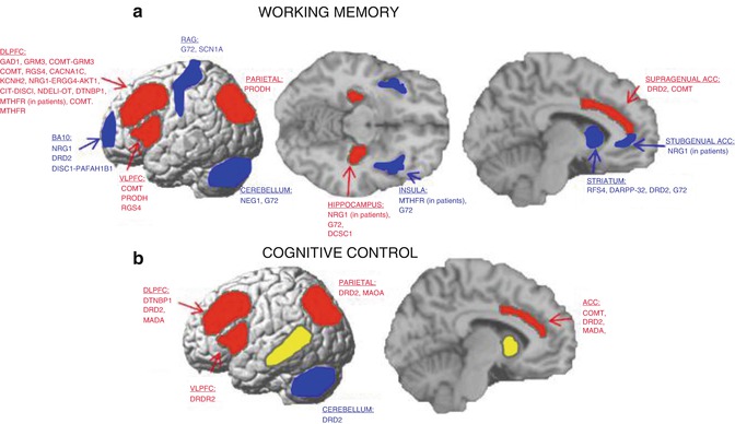 Neuroimaging In Schizophrenia | Radiology Key