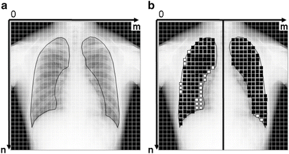 A218098_1_En_12_Fig10_HTML.gif