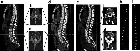 A218098_1_En_7_Fig3_HTML.jpg