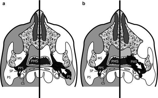 A271823_1_En_1_Fig2a_HTML.jpg