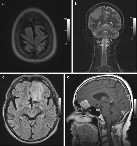 The Head and Neck | Radiology Key