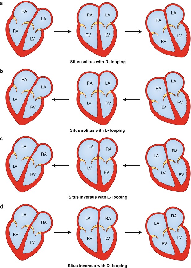 Situs inversus - o que é? - Sinais, Sintomas e Doenças > AbcMed