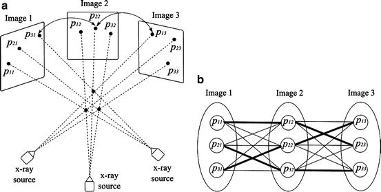 A303895_1_En_23_Fig5_HTML.gif