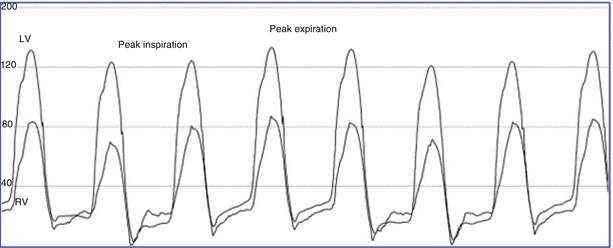 Invasive Hemodynamics | Radiology Key