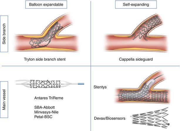 Vascular Access, Closure, And Management | Radiology Key