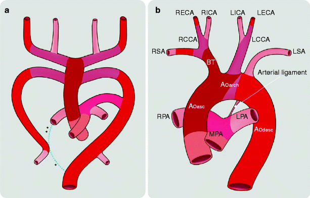 Cardiac Embryology | Radiology Key