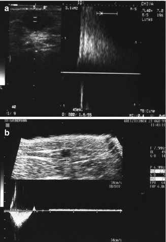 The Ultrasound Scanner | Radiology Key