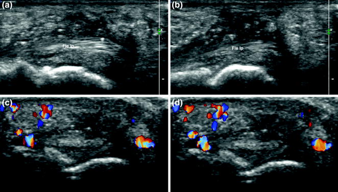 Foreign Bodies | Radiology Key