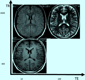 Kernspintomographie | Radiology Key