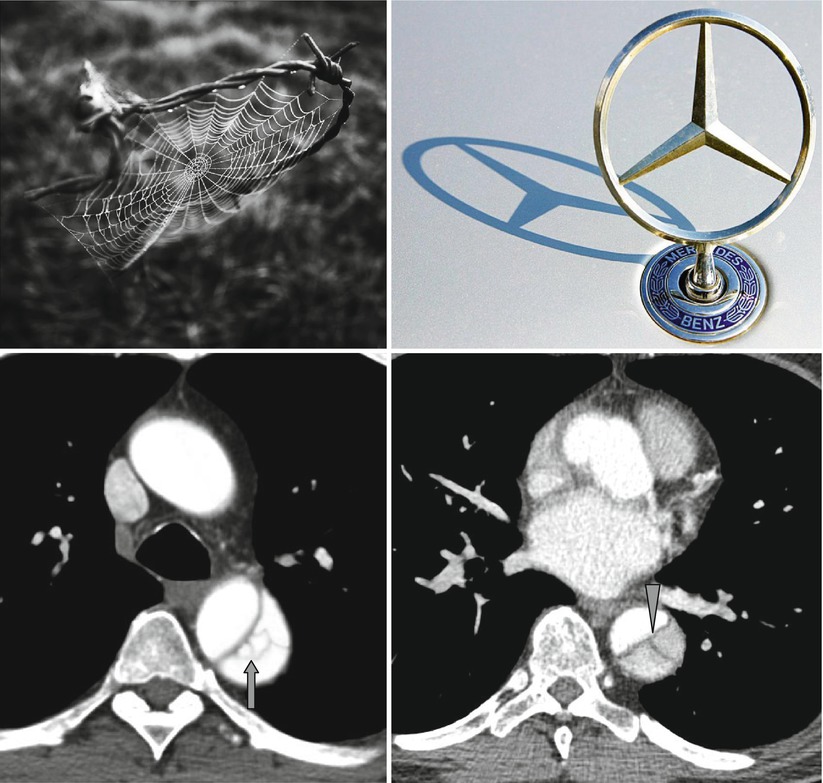 Sign And Mercedes Benz Sign Radiology Key