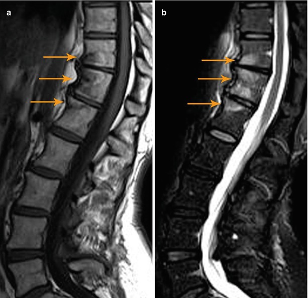 Differential Diagnosis | Radiology Key